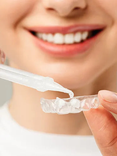 Bleaching: Zähne bleichen – aber richtig!