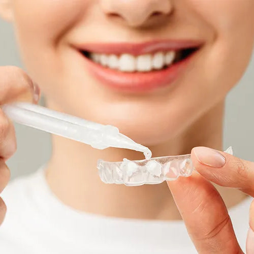 Bleaching: Zähne bleichen – aber richtig!