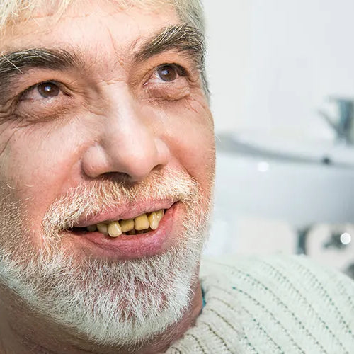 Was tun gegen gelbe Zähne?
