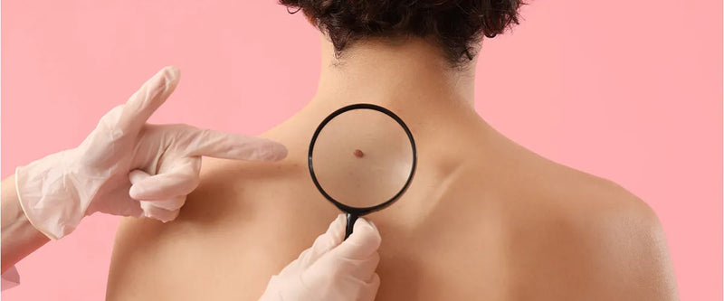 Krebsvorsorge für Männer und Frauen: Welche Untersuchung steht wann an?