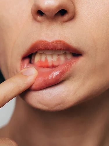 Zahnfleischkrebs: Symptome und Behandlung