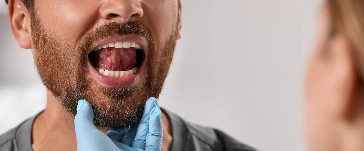 Mukositis behandeln und vorbeugen
