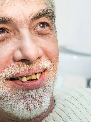 Was tun gegen gelbe Zähne?