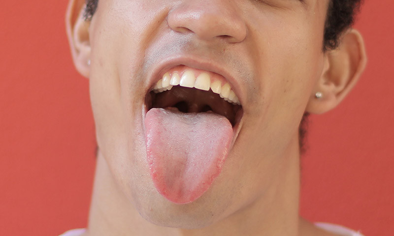 Coated tongue: Symptoms, causes, treatment