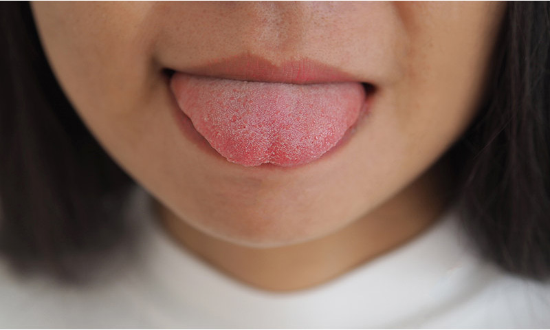 What to do with tongue cancer?