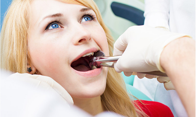 Extracting wisdom teeth: Everything you need to know